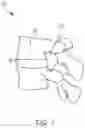 Fig. 02 - Systems and methods for ball probe ultrasonic foraminotomy