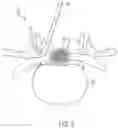 Fig. 04 - Systems and methods for ball probe ultrasonic foraminotomy