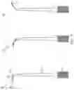 Fig. 12 - Systems and methods for ball probe ultrasonic foraminotomy