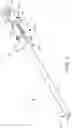 Fig. 04 - SURGICAL INSTRUMENT GUIDE ASSEMBLY