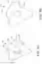 Fig. 12 - SURGICAL INSTRUMENT GUIDE ASSEMBLY