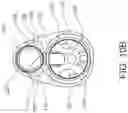 Fig. 15 - SURGICAL INSTRUMENT GUIDE ASSEMBLY