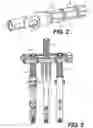 Fig. 03 - Orthopedic derotation devices and methods of installation thereof