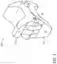 Fig. 02 - Device and method for expanding spacing between spinous processes
