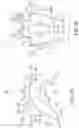 Fig. 05 - Device and method for expanding spacing between spinous processes