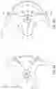 Fig. 07 - Device and method for expanding spacing between spinous processes