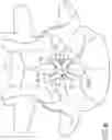 Fig. 11 - Device and method for expanding spacing between spinous processes