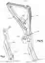Fig. 07 - BI-PLANAR PERSUADER