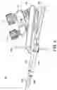 Fig. 03 - Minimally invasive surgery osteotomy fragment shifter, stabilizer, and targeter
