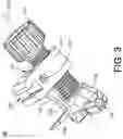 Fig. 04 - Minimally invasive surgery osteotomy fragment shifter, stabilizer, and targeter