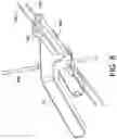 Fig. 09 - Minimally invasive surgery osteotomy fragment shifter, stabilizer, and targeter
