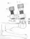 Fig. 13 - Minimally invasive surgery osteotomy fragment shifter, stabilizer, and targeter