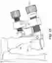 Fig. 16 - Minimally invasive surgery osteotomy fragment shifter, stabilizer, and targeter