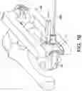 Fig. 17 - Minimally invasive surgery osteotomy fragment shifter, stabilizer, and targeter