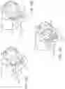 Fig. 11 - SYSTEMS, DEVICES, AND METHODS FOR ABLATION AND DEFUNCTIONALIZATION OF A GALLBLADDER