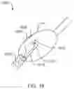 Fig. 19 - SYSTEMS, DEVICES, AND METHODS FOR ABLATION AND DEFUNCTIONALIZATION OF A GALLBLADDER
