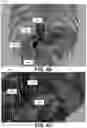 Fig. 08 - SYSTEMS AND METHODS UTILIZING MACHINE-LEARNING FOR IN VIVO NAVIGATION