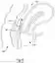 Fig. 06 - Anti-perforation device