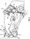 Fig. 06 - GRAVITY COMPENSATION OF END EFFECTOR ARM FOR ROBOTIC SURGICAL SYSTEM