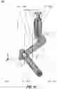 Fig. 15 - GRAVITY COMPENSATION OF END EFFECTOR ARM FOR ROBOTIC SURGICAL SYSTEM