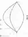 Fig. 18 - GRAVITY COMPENSATION OF END EFFECTOR ARM FOR ROBOTIC SURGICAL SYSTEM