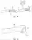 Fig. 09 - System and method for robotically assisting a surgical procedure
