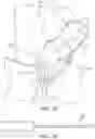 Fig. 16 - System and method for robotically assisting a surgical procedure