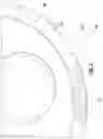 Fig. 03 - Notched Rim Structure for Medical Tools