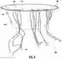 Fig. 09 - Notched Rim Structure for Medical Tools