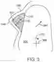 Fig. 05 - Variable direction tooth attachments