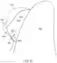 Fig. 08 - Variable direction tooth attachments