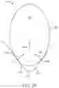 Fig. 09 - Variable direction tooth attachments