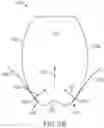 Fig. 10 - Variable direction tooth attachments