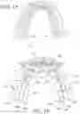 Fig. 02 - Orthodontic assembly