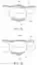Fig. 07 - Orthodontic assembly