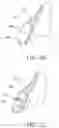 Fig. 08 - Orthodontic assembly