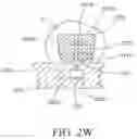 Fig. 14 - Orthodontic assembly