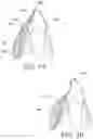 Fig. 16 - Orthodontic assembly