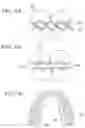 Fig. 17 - Orthodontic assembly