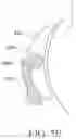 Fig. 20 - Orthodontic assembly