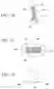 Fig. 23 - Orthodontic assembly