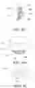 Fig. 26 - Orthodontic assembly