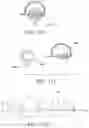 Fig. 35 - Orthodontic assembly