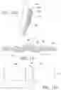 Fig. 36 - Orthodontic assembly