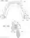 Fig. 45 - Orthodontic assembly
