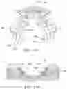 Fig. 46 - Orthodontic assembly