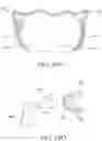 Fig. 48 - Orthodontic assembly