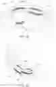 Fig. 03 - METHODS AND SYSTEMS FOR CREATING IMPROVED ORTHODONTIC ALIGNERS WITH TONGUE SPIKES