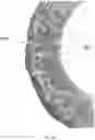 Fig. 13 - METHODS AND SYSTEMS FOR CREATING IMPROVED ORTHODONTIC ALIGNERS WITH TONGUE SPIKES
