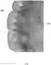 Fig. 14 - METHODS AND SYSTEMS FOR CREATING IMPROVED ORTHODONTIC ALIGNERS WITH TONGUE SPIKES